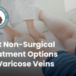 Best Non-Surgical Treatmnet Options for Varicose Veins