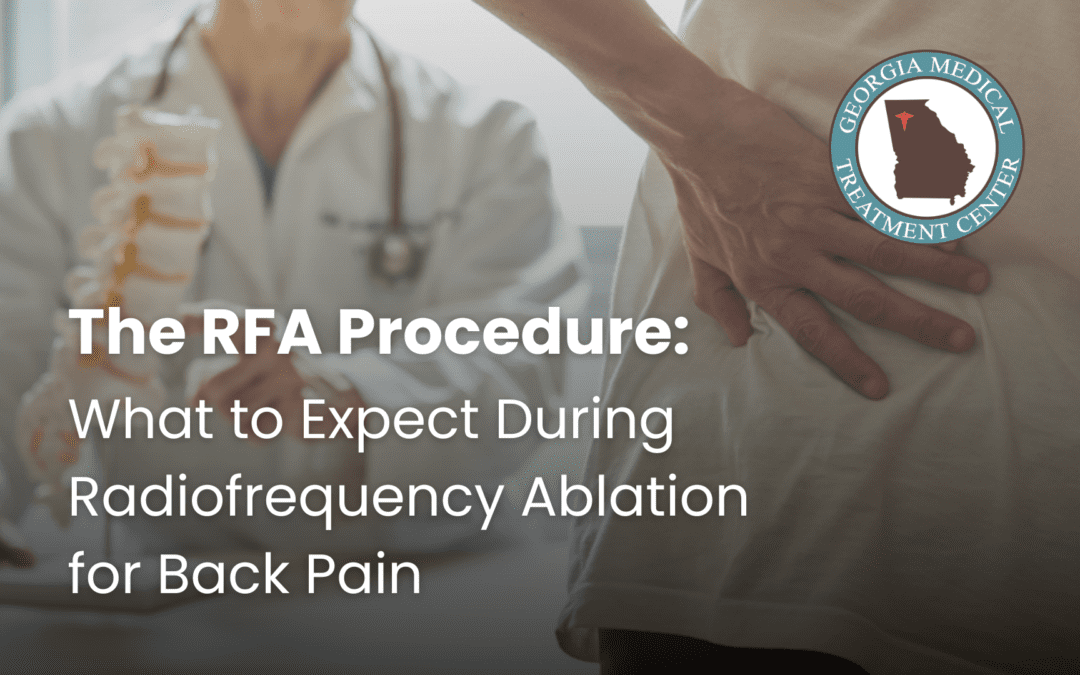 The RFA Procedure: What to Expect During Radiofrequency Ablation for Back Pain