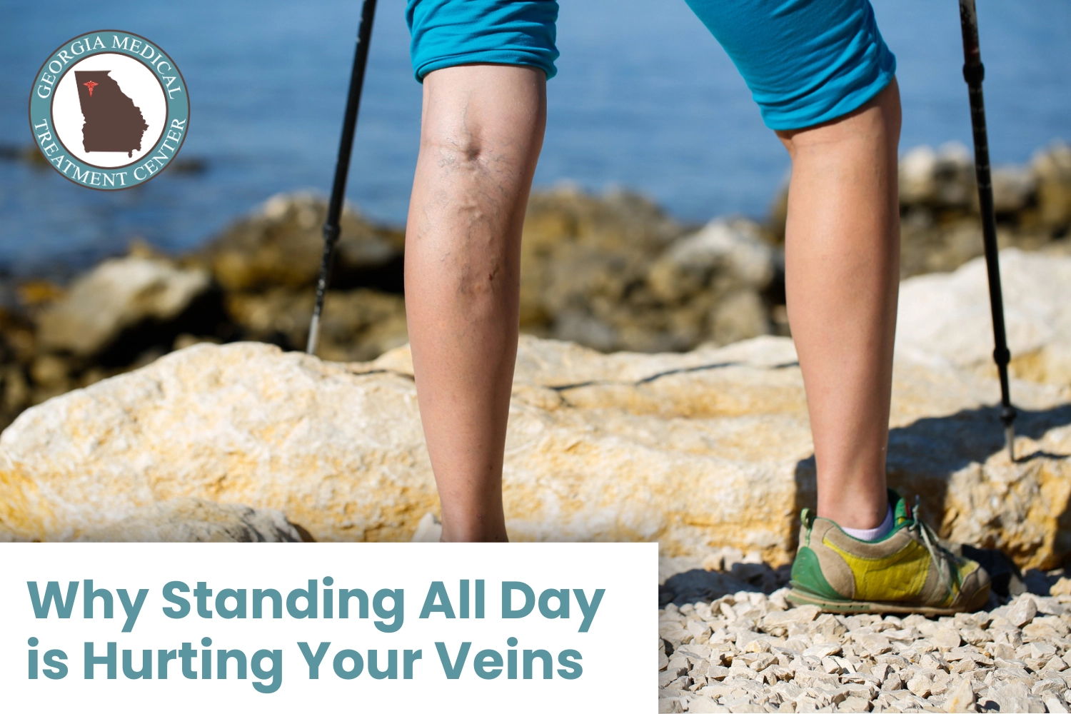 Why Standing All Day Is Hurting Your Veins Why Standing All Day Is Hurting Your Veins
